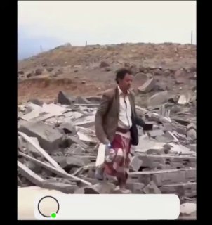 תקיפות אוויריות של סעודיה הרגו 21 בני אדם ופצעו 30 ברחבי חמישה אזורים בתימן תוך 24 שעות, לפי נתונים מממשלת…