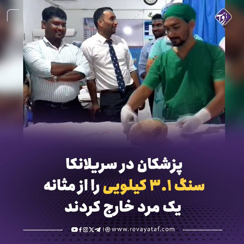 روایت revayataf: ▪️ پزشکان در سریلانکا یک سنگ ۳.۱ کیلوگرامی را از مثانه مردی ۵۵ ساله خارج کردند که به گفته آنان، بزرگترین سنگ مثانه ثبت